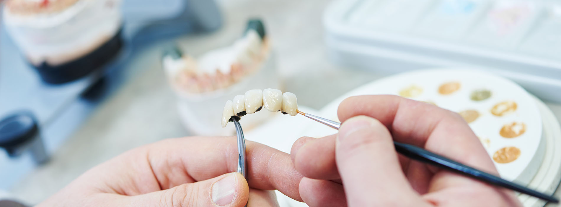 dental lab banner