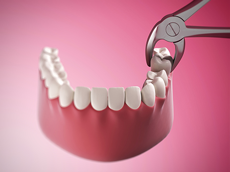 GD Dentistry | Implant Restorations, Periodontal Treatment and Veneers